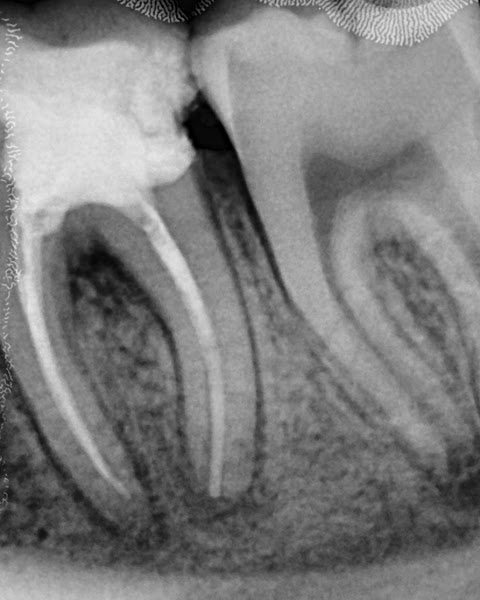 Foto 3 de Dentista Alexandre Lacerda