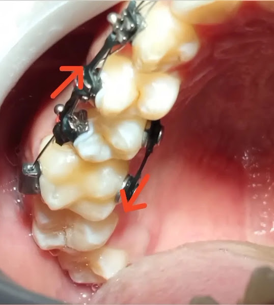 Foto 3 de Dentista Amarilis Curi