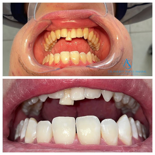 Foto 2 de Dentista Andrey Simões Amaral