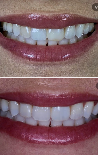 Foto 2 de Dentista Apucarana/ Clínica Odontológica Humanizar