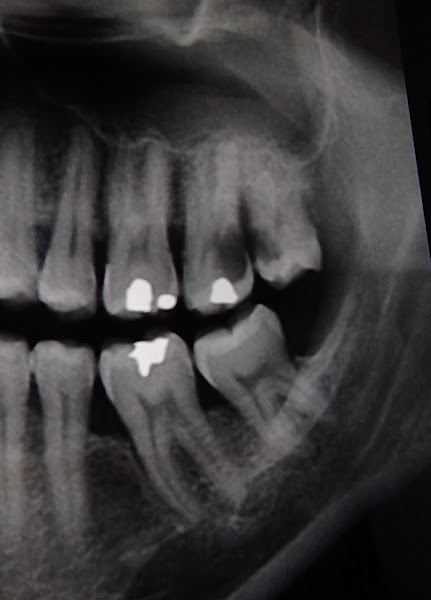 Foto 3 de Dentista Arapiraca - Dr. Evanio Silva