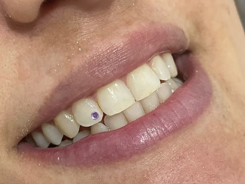 Foto 5 de Dentista Aricanduva - Dra Grasiela Haddad
