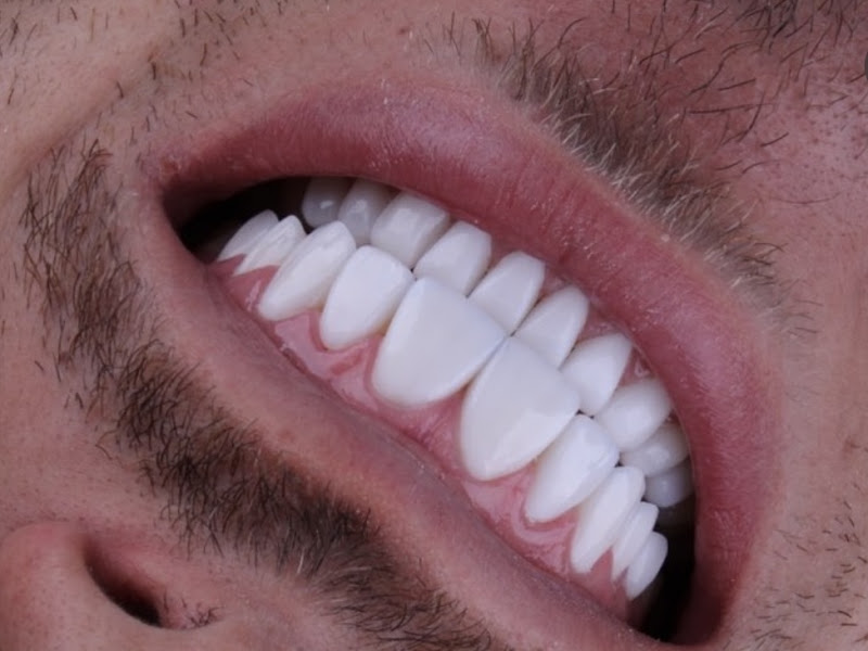 Foto 3 de Dentista Belo Horizonte - Dentista BH