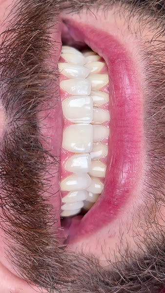 Foto 4 de Dentista Belo Horizonte Dr. Leonardo Trindade