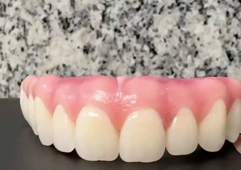 Foto 2 de Dentista Belo Horizonte - Dra. Pollyana Lacerda | Implante Dentário e Reabilitação Oral em Belo Horizonte