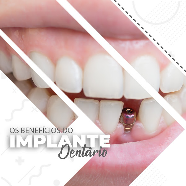 Foto 2 de Dentista Bernardos Premier