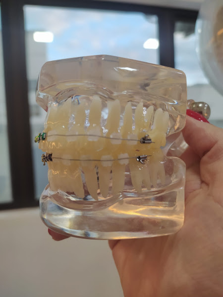 Foto 3 de Dentista Breno Queiroz