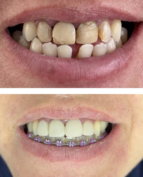 Foto 2 de Dentista Brooklin Dra. Débora Marchetti