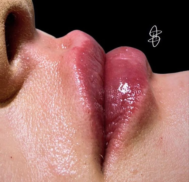 Foto 2 de Dentista Bruna W. Erthal - Odontologia Estética e Harmonização Orofacial