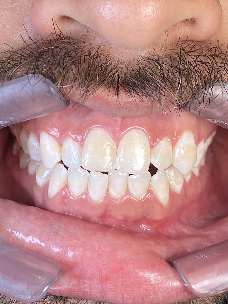 Foto 3 de Dentista (Campina Grande - PB) Dr.Vinícius Silva