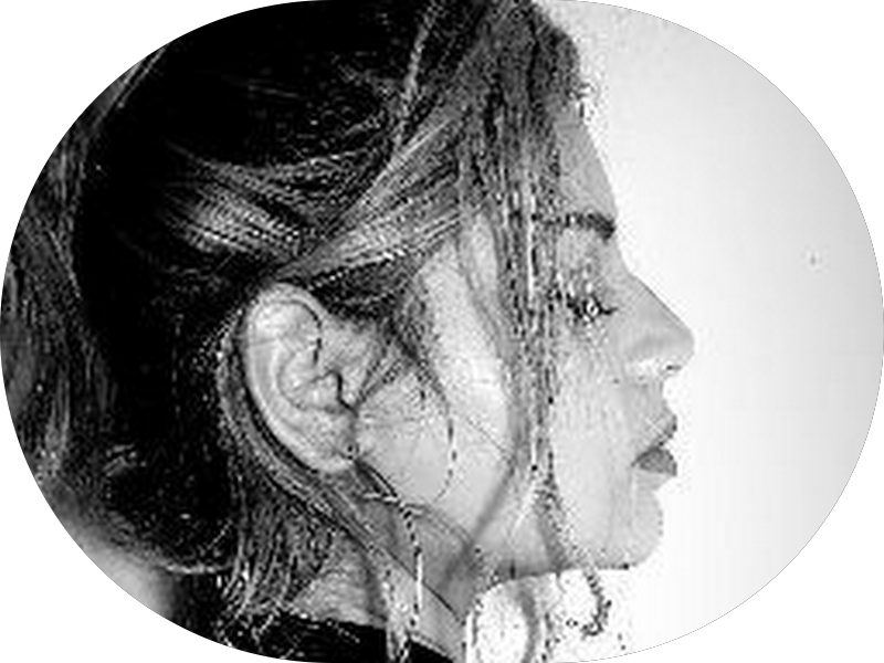 Foto 4 de Dentista Campo Grande RJ | Amil Hapvida Metlife Primavida Sulamérica Unimed