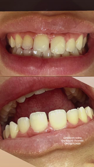 Foto 5 de DENTISTA Campos Odonto Odontologia especializada Dr Luciana Campos