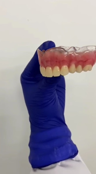 Foto 3 de Dentista canoas - Dra Raquel Machry/ tratamento de canal, lentes, clareamento dental, próteses dentarias