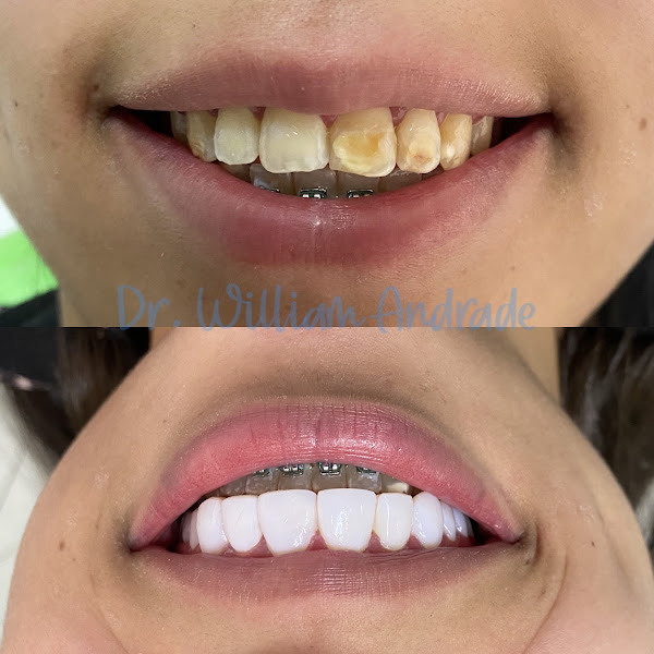 Foto 3 de Dentista Carapicuiba WJ ANDRADE ODONTOLOGIA