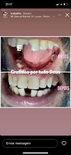Foto 2 de Dentista Cidade das Luze - SORRIIBEM