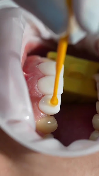 Foto 3 de Dentista Cidade das Luze - SORRIIBEM