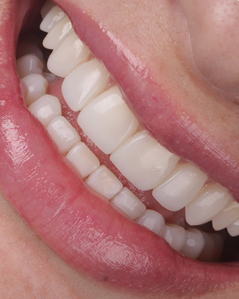 Foto 3 de Dentista | Clareamento | Facetas | Consultório Odontológico Ana Paula Bolzan - Atendimento em Ponta Grossa