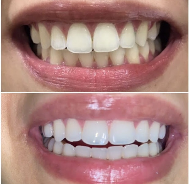 Foto 2 de Dentista (consultório odontológico Dr Bruno santos Oliveira CROSP 139.801)