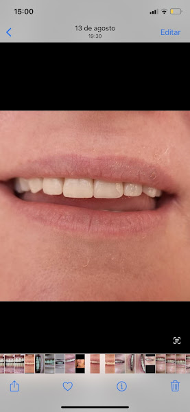 Foto 3 de Dentista (consultório odontológico Dr Bruno santos Oliveira CROSP 139.801)