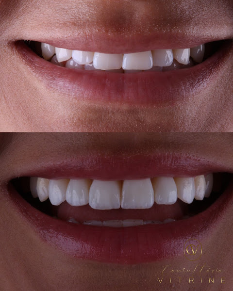 Foto 3 de Dentista Copacabana - Consultório Odontológico Vitrine