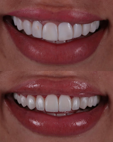 Foto 2 de Dentista Cotia | Dr. Naor Maldonado