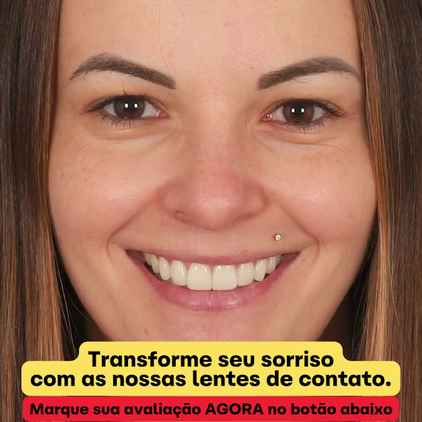 Foto 2 de Dentista Cruz e Mendonça - Implante Dentário Tijuca
