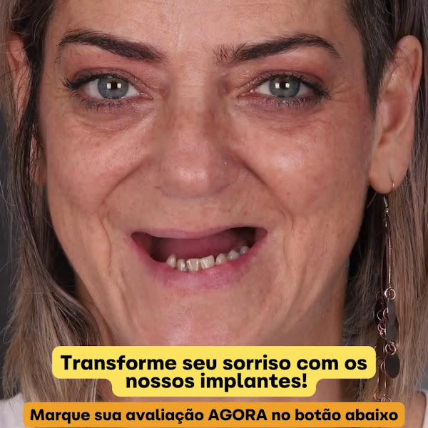 Foto 3 de Dentista Cruz e Mendonça - Implante Dentário Tijuca