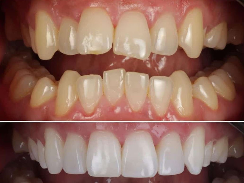 Foto 8 de Dentista Curitiba Alethea Gradella Odontologia e Bem Estar