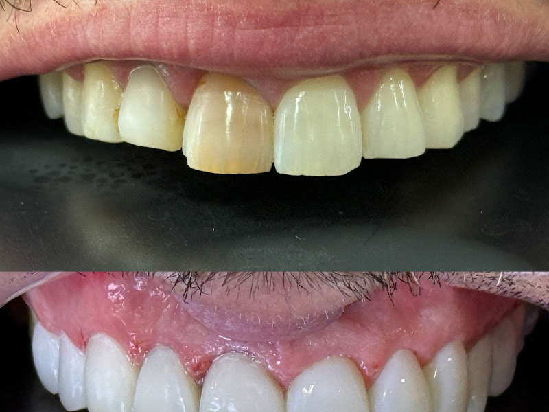 Foto 6 de Dentista Curitiba - Ame Odontologia | Dra. Juliana de Andrade Mendes