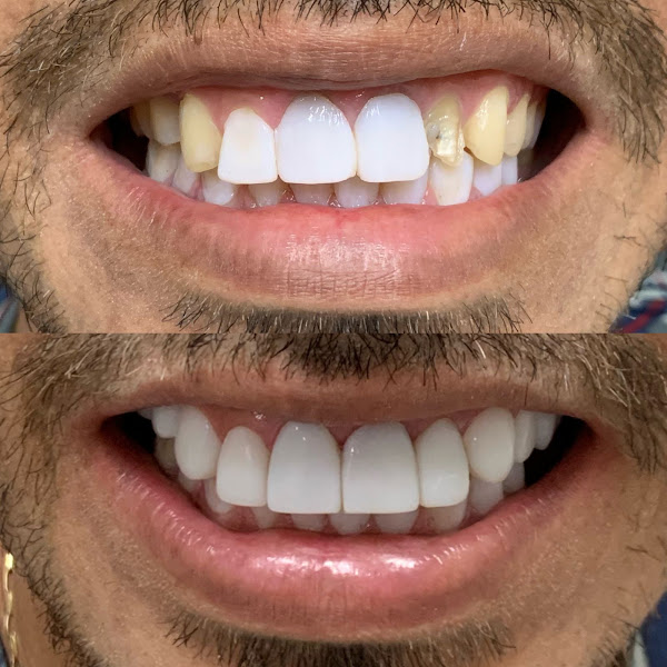 Foto 2 de Dentista da família- Henrique Martins 100