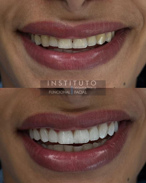 Foto 3 de 🤵DENTISTA DE URGENCIA 24HS - Dentista em Moema (BUCOMAXILOFACIAL) Implantes - Protocolo - Cirurgia Ortognática - ATM - Sisos.