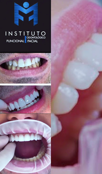 Foto 4 de 🤵DENTISTA DE URGENCIA 24HS - Dentista em Moema (BUCOMAXILOFACIAL) Implantes - Protocolo - Cirurgia Ortognática - ATM - Sisos.
