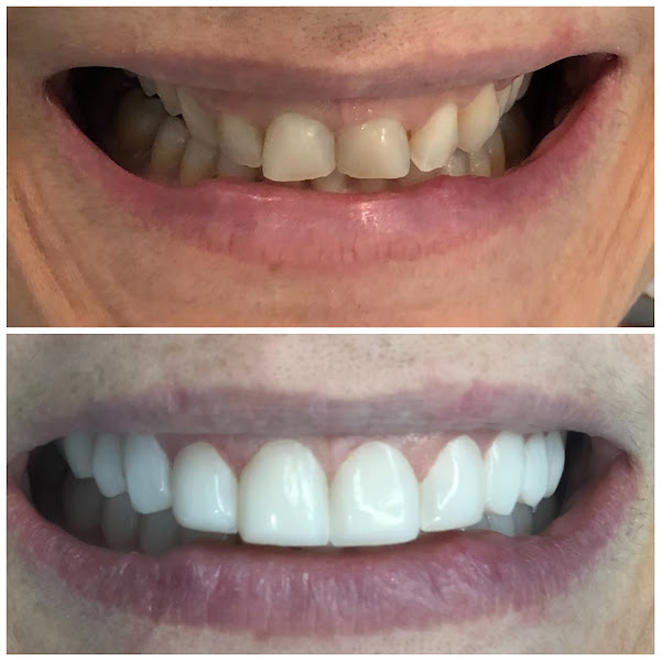 Foto 2 de Dentista de Urgência - agende no WhatsApp - Praia Grande