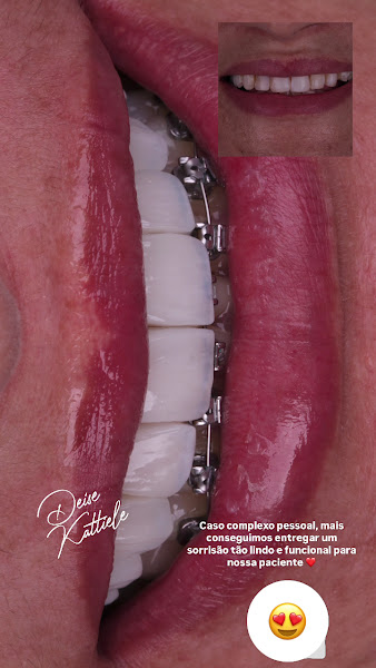 Foto 3 de Dentista Deise Kattiele