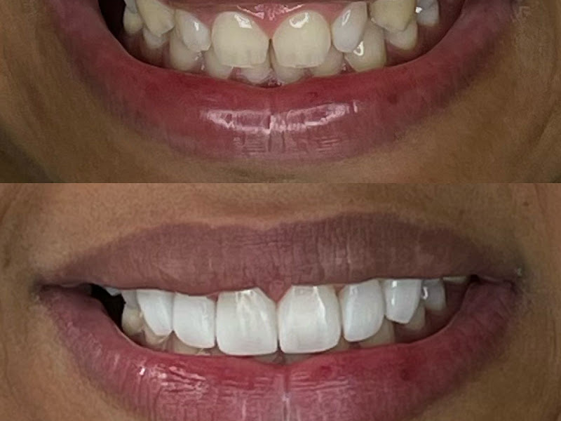 Foto 3 de Dentista - Diogo