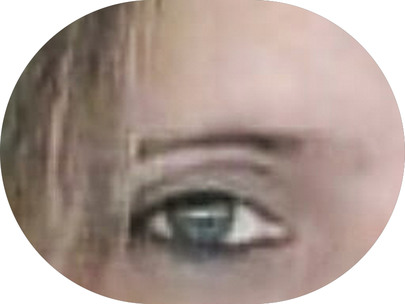 Foto 8 de Dentista Divinópolis | Lentes de Contato | Invisalign | Implante Dentátio | Clínica Murad