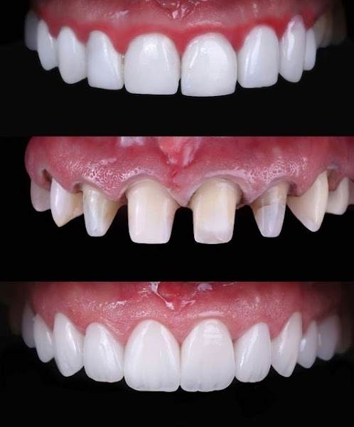 Foto 2 de Dentista do sorriso