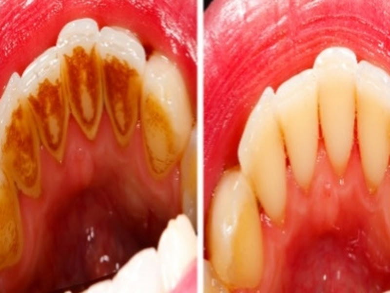 Foto de Dentista Doutora Lisiane Santodonto