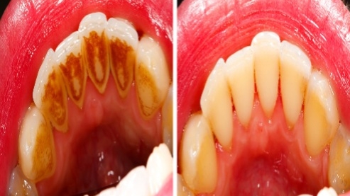 Foto 2 de Dentista Doutora Lisiane Santodonto