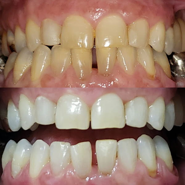 Foto 2 de Dentista Dr Alexandre Juliano dos Santos