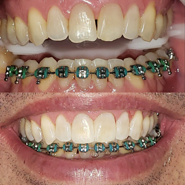 Foto 3 de Dentista Dr Alexandre Juliano dos Santos