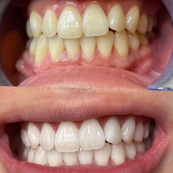Foto 2 de Dentista Dr Alexandre Schadeck Meier