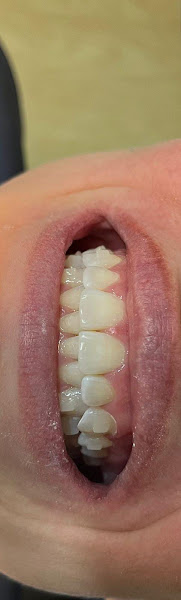 Foto 3 de Dentista Dr Alexandre Schadeck Meier