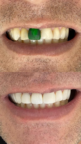 Foto 2 de DENTISTA - Dr. Allon Roter