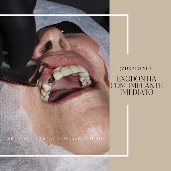 Foto 3 de Dentista - Dr. Aloisio Francisco Jacoby Junior