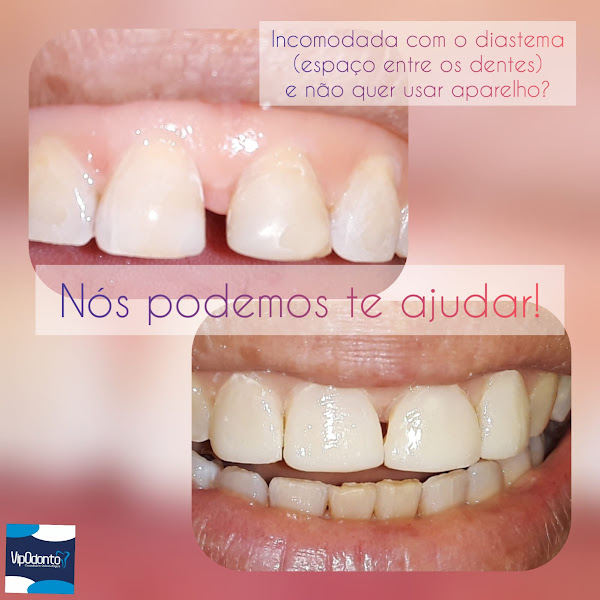 Foto 3 de Dentista - Drª Amanda Carvalho e Drª Isadora Macedo