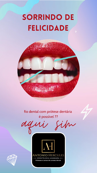 Foto 3 de Dentista Dr Antonio Hercules - Odontologia Avançada - Próteses e Lente de Contato - Londrina