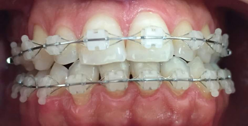 Foto 3 de Dentista - Dr. Arthur Carlos da Silva Júnior