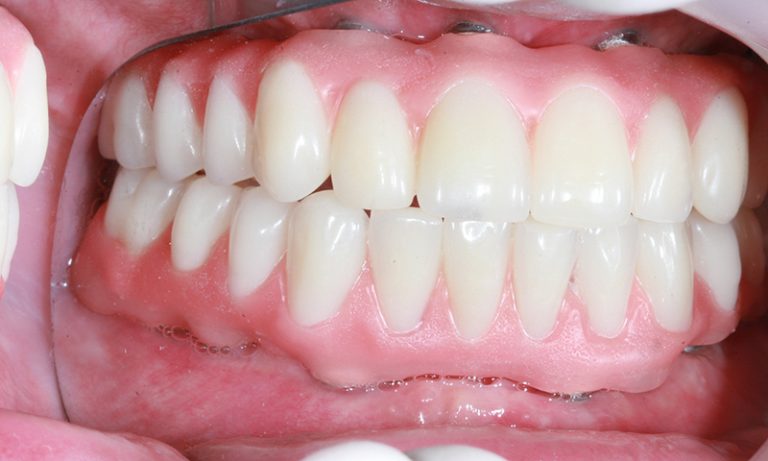 Foto 2 de DENTISTA: Dr Carlos Eduardo dos Santos Thuler
