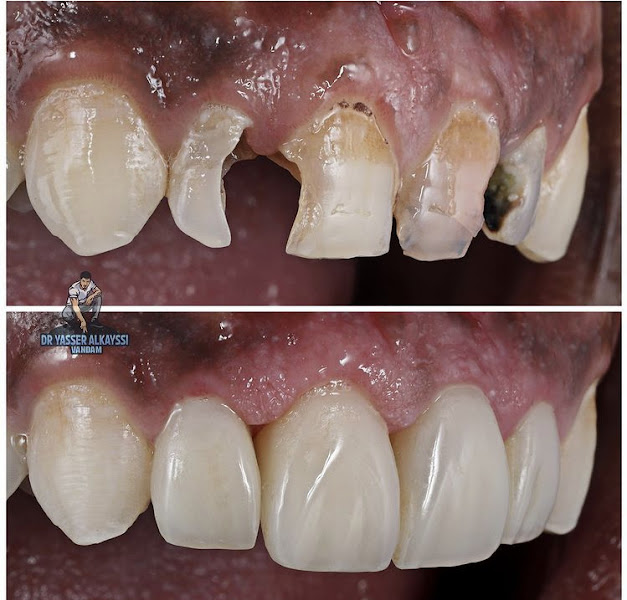 Foto 3 de DENTISTA: Dr Carlos Eduardo dos Santos Thuler
